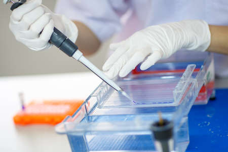 Woman hand loading samples into  gel for electrophoresisの写真素材