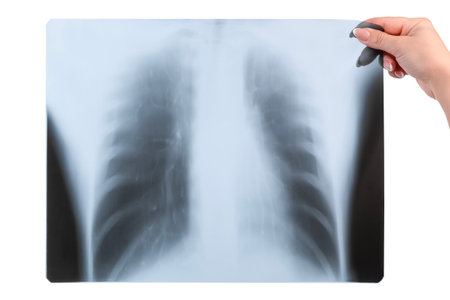in a female hand x-ray of the lungs isolated on a white background.