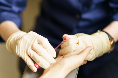 medical nurse with latex gloves is taking patient's blood for analysis at day timeの写真素材