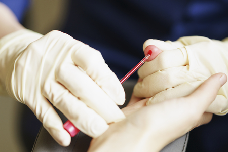 medical nurse with latex gloves collect blood for analysis or HIV test at day timeの写真素材