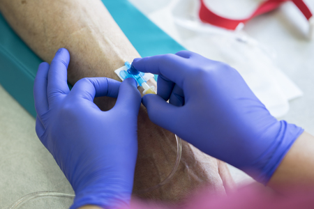 medical nurse with blue latex gloves inputs catheter to vein patient for drip of chemotherapy or another liquid medicine from cancerの写真素材