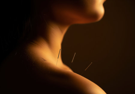 Close up, dramatic view of acupuncture needles placed in the shoulder and neck area. representing alternative medicine, wellness, healing, and pain management.の素材