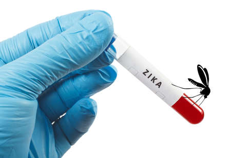Zika virus test, blood sampleの写真素材
