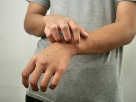 Anonymous man feel itchy, scratching his hand in pain, close upの写真素材