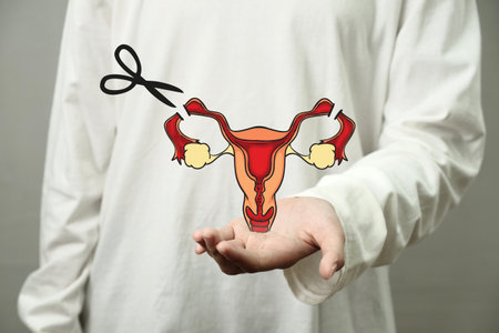 Digital illustration of female sterilization by tie and cut the fallopian tubes procedure, health and medical conceptの写真素材
