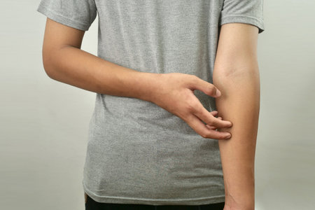 Anonymous man feel itchy, scratching his hand in pain, close upの写真素材