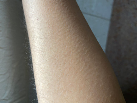 Close-up of a woman's skin with goosebumps.の写真素材
