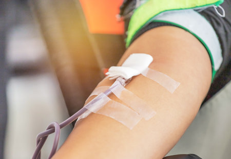 Volunteer blood donor at donation while transfusion blood at laboratory hospitalの写真素材
