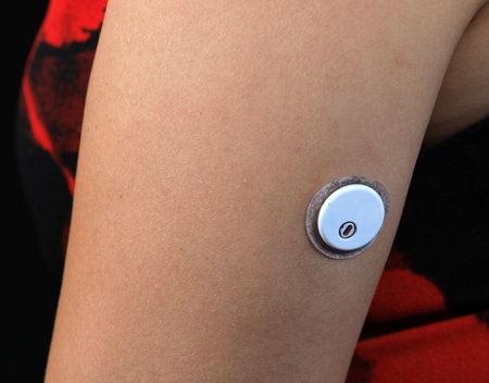 Close-up Of A Woman Testing Glucose Level With A Continuous Glucose Monitor On Her Arm