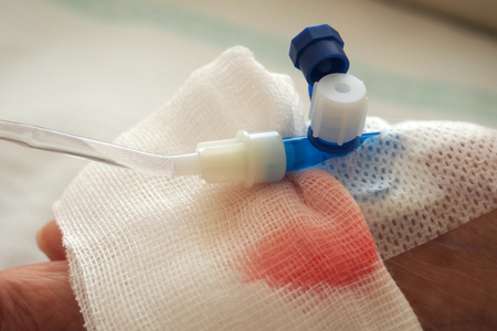 Hand and catheter with drip attachedの写真素材