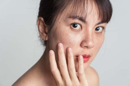 Young Asian woman worry with freckle on face and hand gently touching cheek applying skincare cosmetics treatment.の写真素材