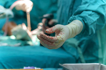 Selective focus, Surgeon hand in medical glove during surgery help patient in operating room.の写真素材