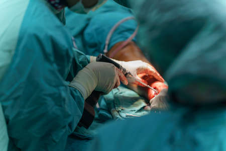 Selective focus hand of Orthopedic doctor during surgery use medical instruments plate and screw...