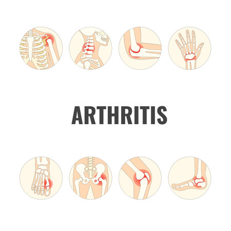 Vector Illustration of World Arthritis Dayのイラスト素材