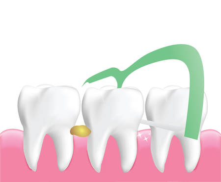 Dental Floss Picks, Dental Cleaning Tool isolated on white background, Realistic design illustration Vector.のイラスト素材