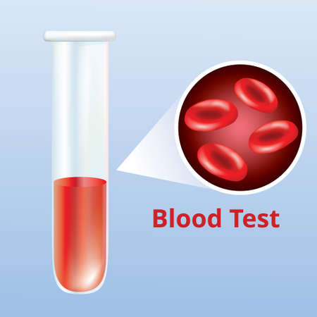 Blood test with medical tube with red blood cells , vector illustrationのイラスト素材