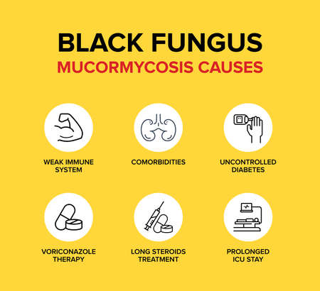 Black Fungus or Mucormycosis Causes.のイラスト素材