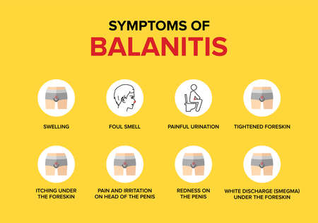 What are the symptoms of balanitis?のイラスト素材