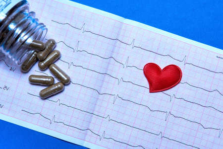 Cardiogram, pills and a toy heart on a colored background.