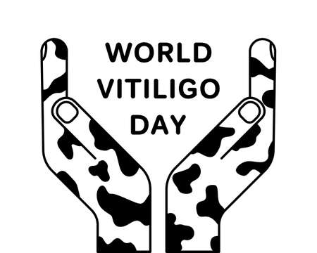 World vitiligo day. Square poster or card template. Two symmetric human hands and text. Linear icon. Black simple illustration of celebration banner. Contour isolated vector image on white backgroundのイラスト素材