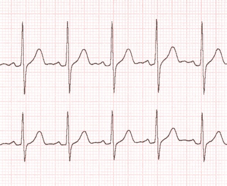 cardiogram on the background gridの写真素材