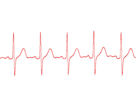 cardiogram on a white background