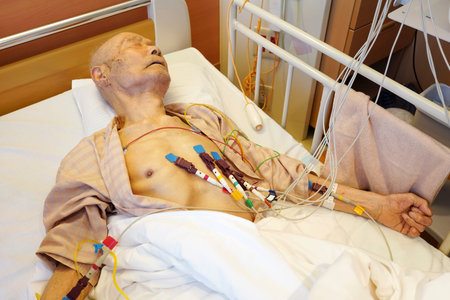 Japanese Old Man Patient Lying on Bed, Take a Cardiogram in Hospital