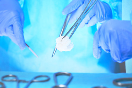 Close-up of of surgeons hands at work in operating theater toned in blue. Medical team performing operationの写真素材