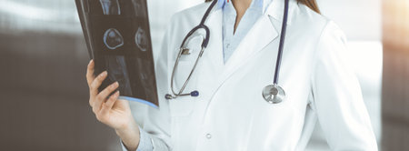 Professional young woman doctor is looking at her patients roentgenogram in sunny clinic. Medicine concept during Coronavirus pandemic. Covid-2019の写真素材