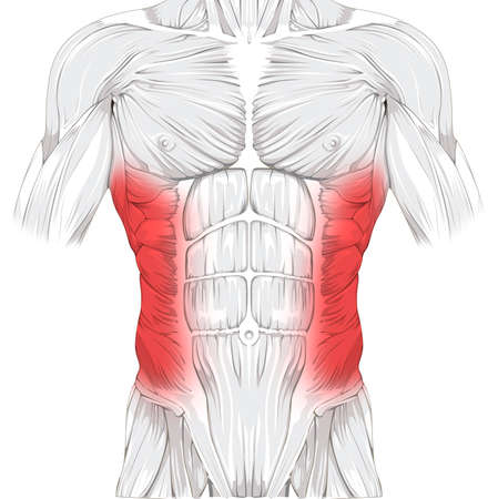 Side Strain (Abdominal) Illustrationの写真素材
