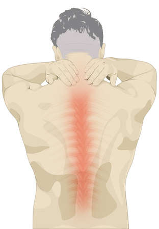 Man holding his neck with osteoporosisの写真素材