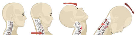 Whiplash Injury during car accidentの写真素材