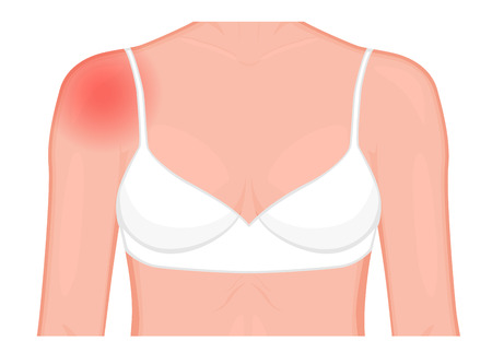 Vector illustration of a human shoulder joint with a pain or injury. Front view. For advertising, medical publications. EPS 10のイラスト素材