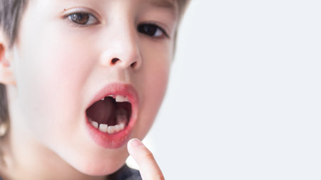 Smiling kid shows hole in row of teeth in his mouth. One incisor fell out just now. Close up photo...