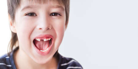 Smiling kid shows hole in row of teeth in his mouth. One incisor fell out just now. Close up photo of gums for dentist. Banner with copy space.の写真素材