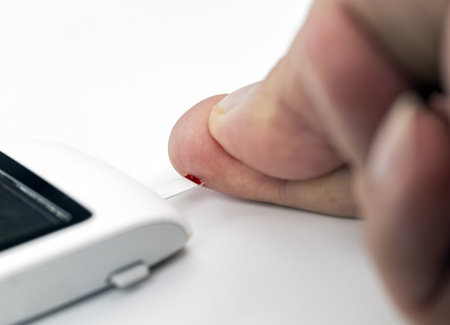 A person using blood glucose test device to check their blood sugar level by pricking their finger. image focuses on hand and device, highlighting process of monitoring diabetesの写真素材