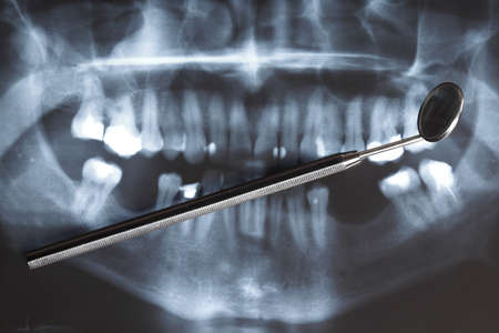 Panoramic x-ray image scan of humans teeth and dental mirrorの写真素材