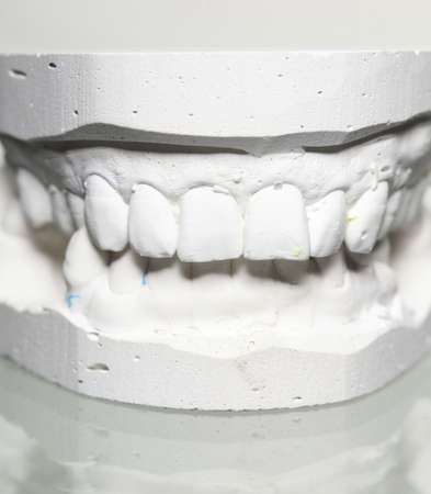 Dental casting gypsum model plaster cast stomatologic human jaws prothetic laboratory, technical shotsの写真素材