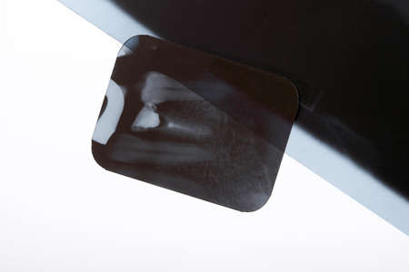 a dental x-ray film detail isolated on whiteの写真素材
