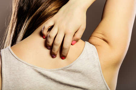 Health problem. Closeup young woman scratching her itchy back with allergy rash