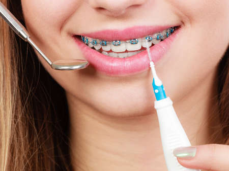 Dental health care, stomatology concept. Woman with braces having dentist appointment, looking at teeth with small mirror and cleaning using tiny toothbrush.の写真素材
