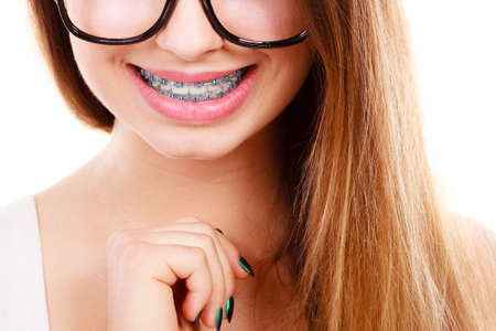 Vision and dentistry problems concept. Happy nerdy teenage wearing big eyeglasses showing her braces on teethの写真素材