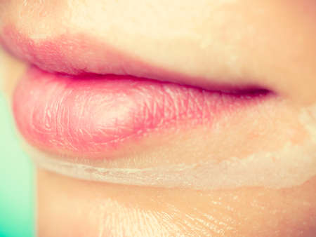 Close up young woman in facial peel off mask, part of face. Peeling. Wellness and skincare.の写真素材