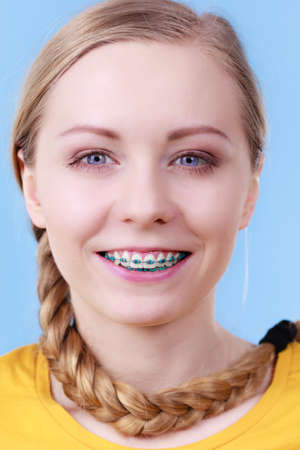 Dentist and orthodontist concept. Woman smile showing her white teeth with blue bracesの写真素材