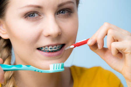 Dentist and orthodontist concept. Young woman smiling cleaning and brushing teeth with braces using toothbrushの写真素材