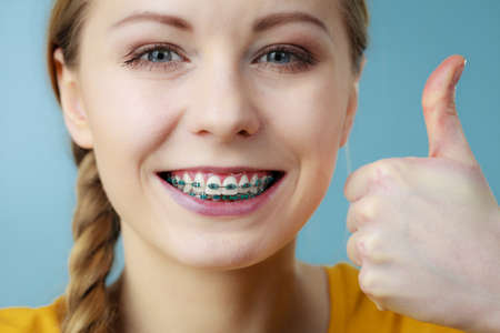 Dentist and orthodontist concept. Young woman teen girl smiling showing teeth with braces, making thumb up hand sign gesture, on blueの写真素材