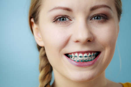 Dentist and orthodontist concept. Young woman teen girl smiling showing teeth with braces, on blue