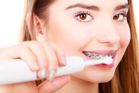 Dentist and orthodontist concept. Young woman cleaning and brushing teeth with blue braces using toothbrushの写真素材
