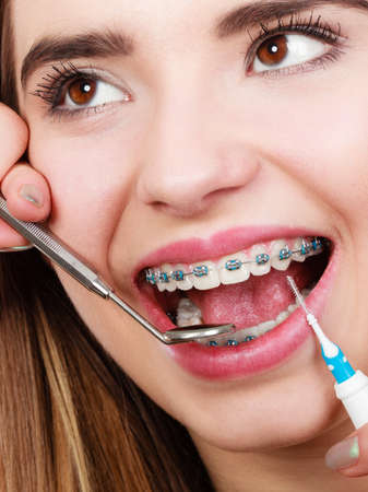 Dental health care, stomatology concept. Woman with braces having dentist appointment, looking at teeth with small mirror and cleaning using tiny toothbrush.の写真素材