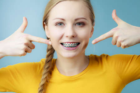 Dentist and orthodontist concept. Young woman teen girl smiling pointing with fingers on teeth with braces, on blueの写真素材